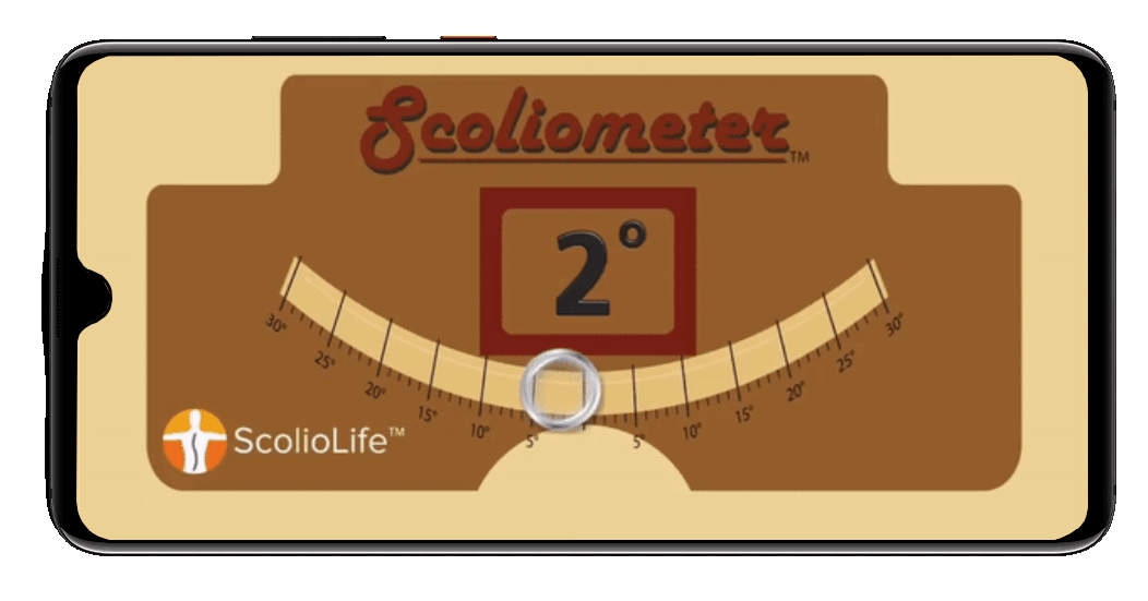Scoliometer